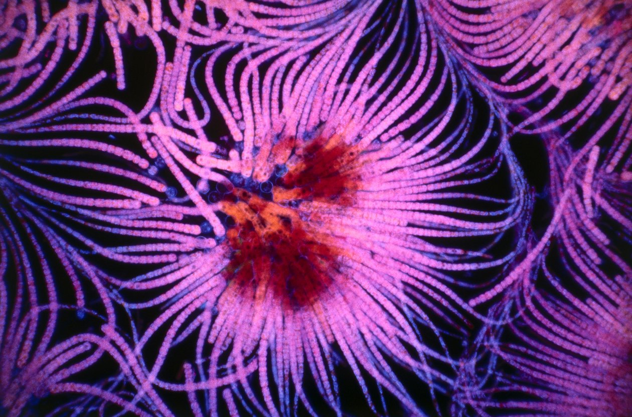 Dia met cluster van een eencellig organisme genaamd cyanobacteriën door Unknown