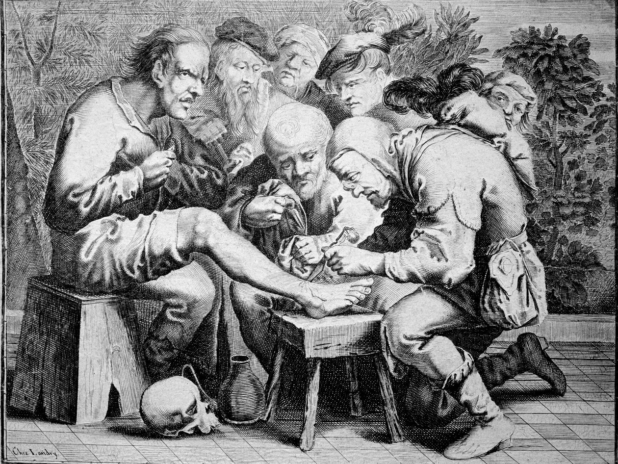Enkeloperatie (gravure) door Anonymous Anonymous