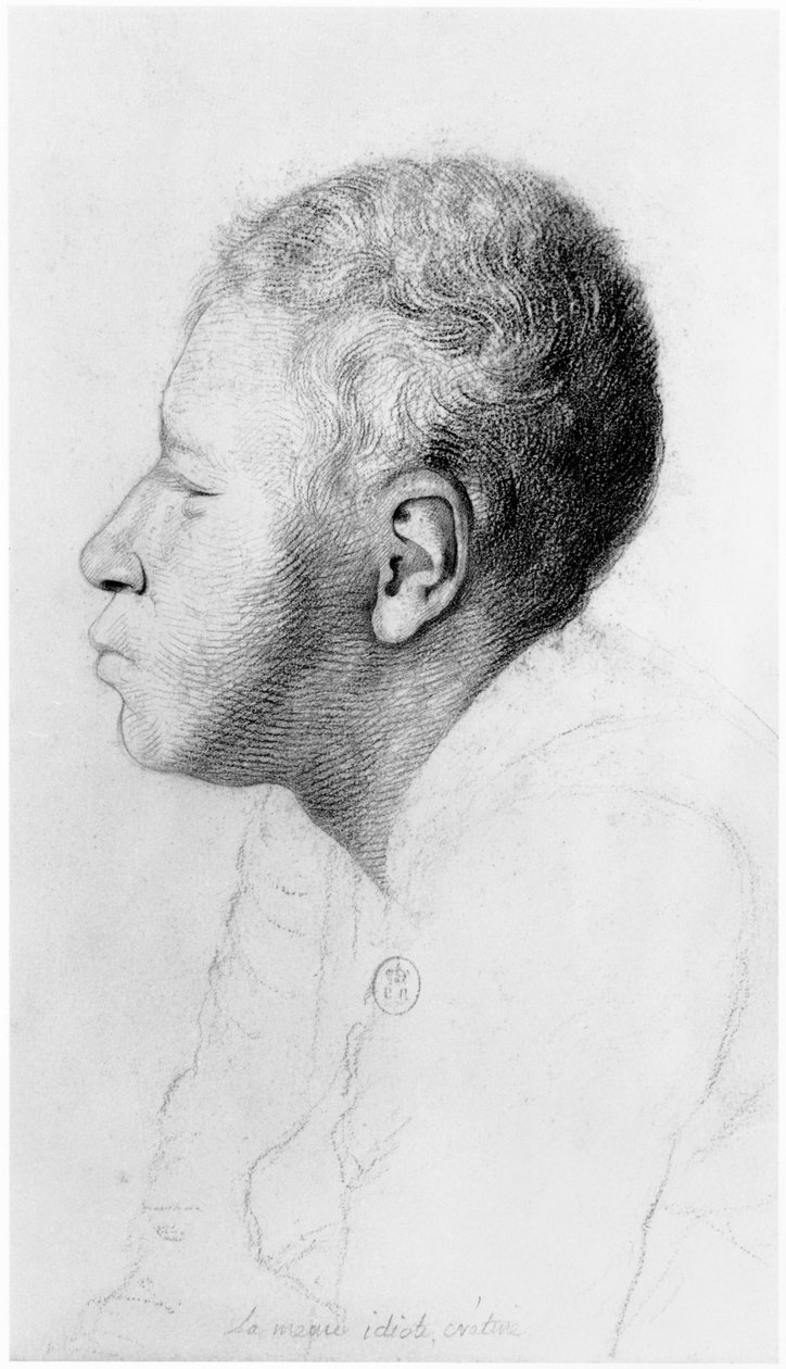 Kretin, profiel, illustratie uit een onuitgegeven verhandeling door Jean Etienne Dominique Esquirol (1772-1840) over de krankzinnigen van het Salpetriere-asiel, ca. 1818 door Georges Francois Gabriel