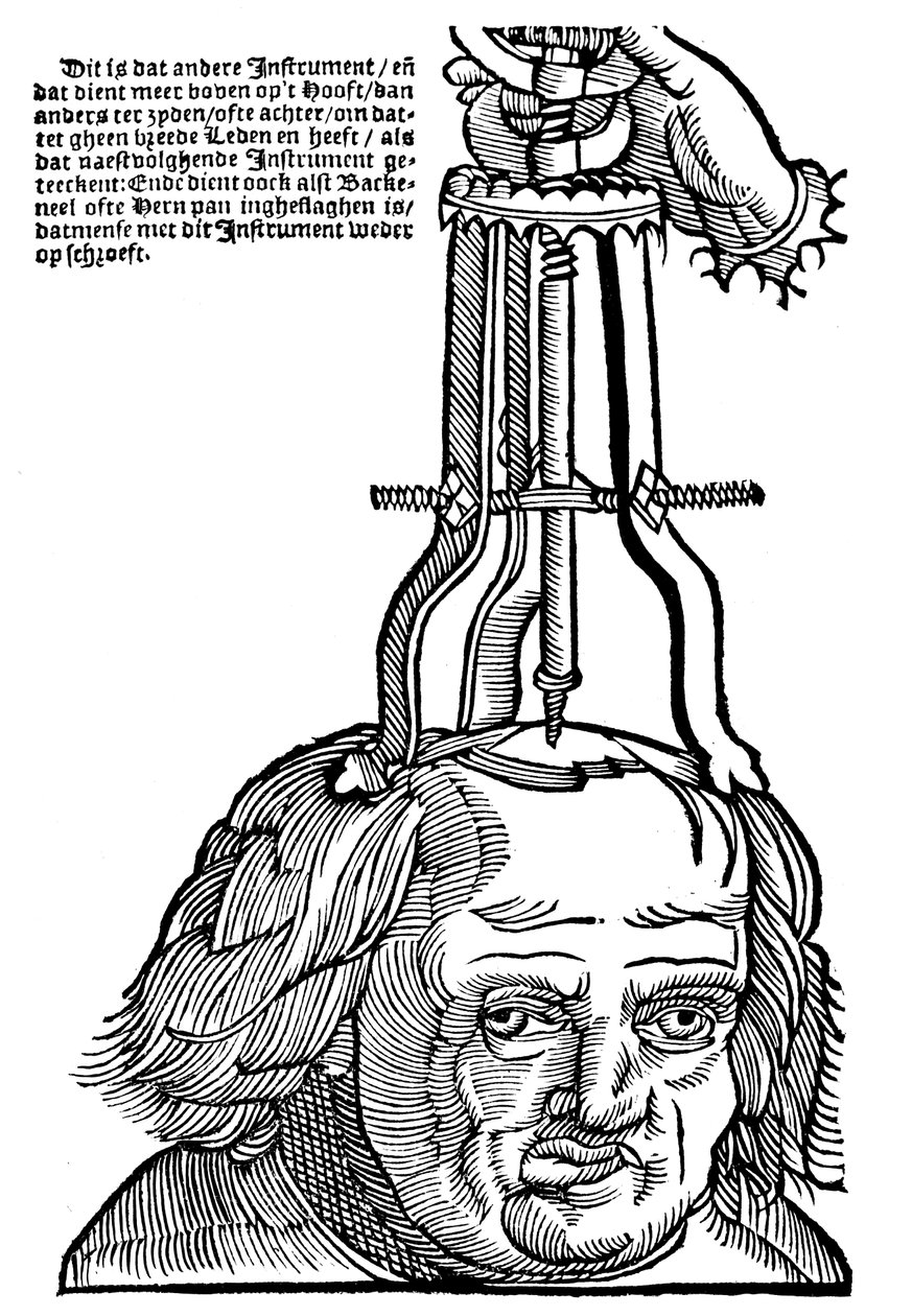 Trepanatie, 1593 door Unbekannt