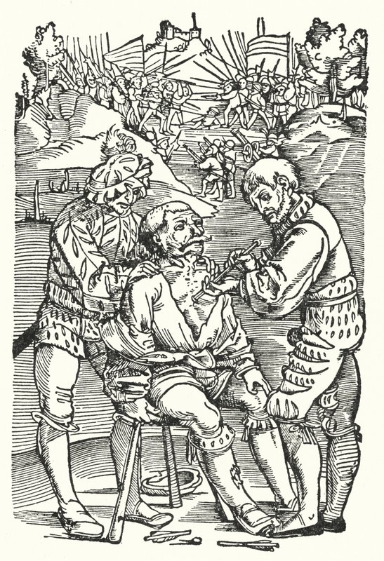 Barbier chirurg die een pijl verwijdert door European School